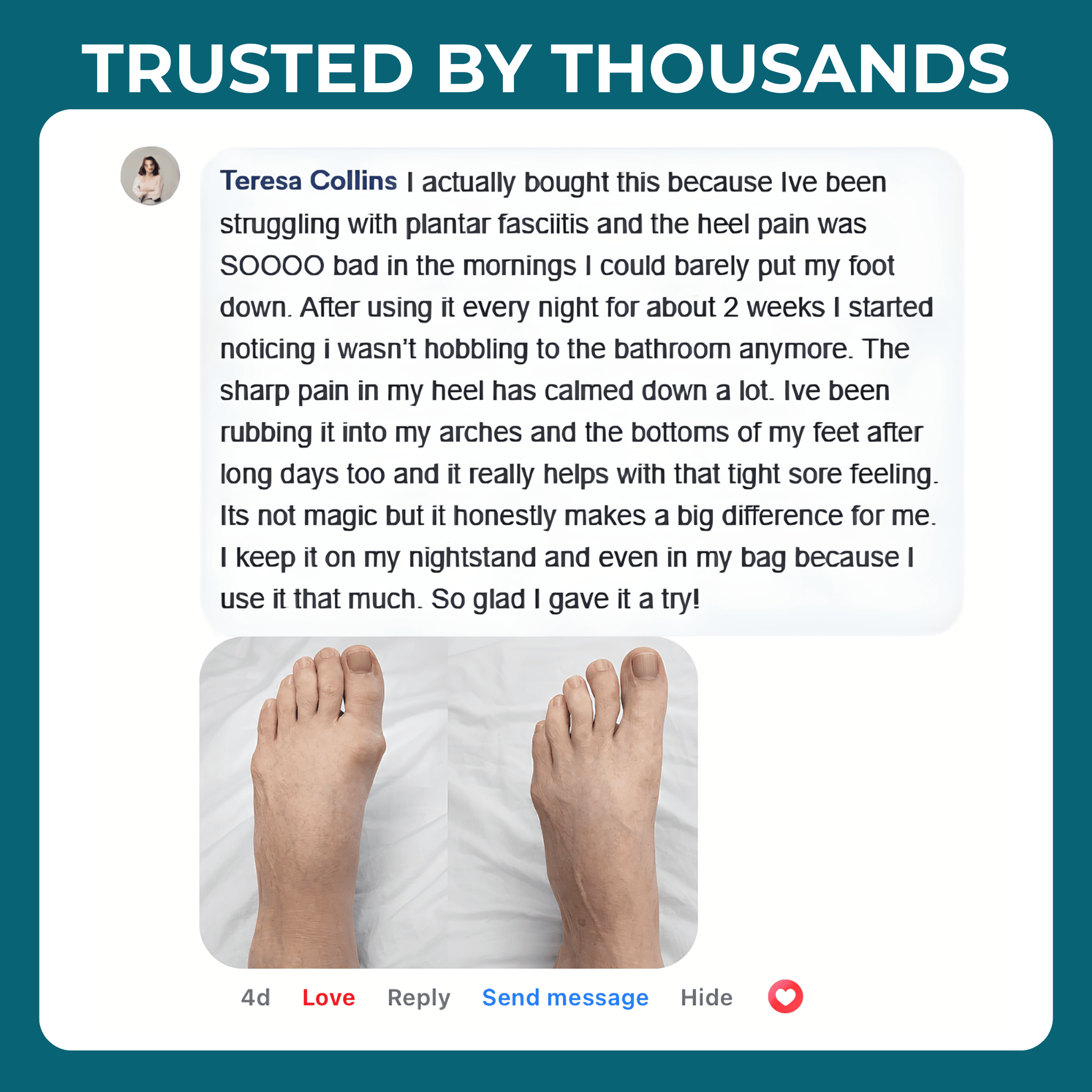 The Ingoodness  Balm™ Plantar Fasciitis Recovery Formula